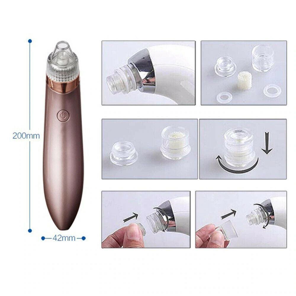 Electric Blackhead Vacuum Pore Cleaner Acne Pimple Remover Strong Suction Tool Electric Blackhead Remover Pore Vacuum Suction Diamond Dermabrasion Face Cleaner.