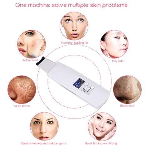 Ultrasonic Skin Scrubber Face Cleanser Blackhead Acne Removal Facial Spa Vibration Massager Ultrasound Peeling Clean Machine 394.