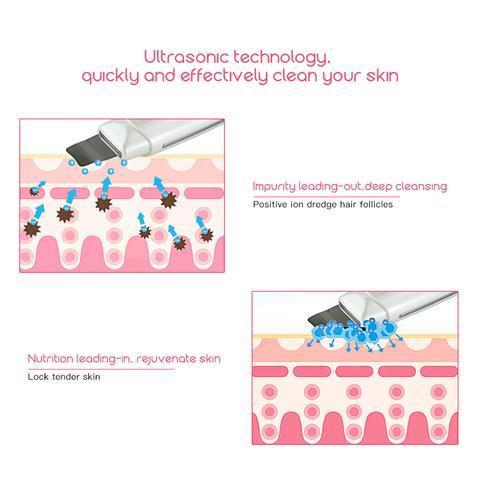Ultrasonic Skin Scrubber Face Cleanser Blackhead Acne Removal Facial Spa Vibration Massager Ultrasound Peeling Clean Machine 394.