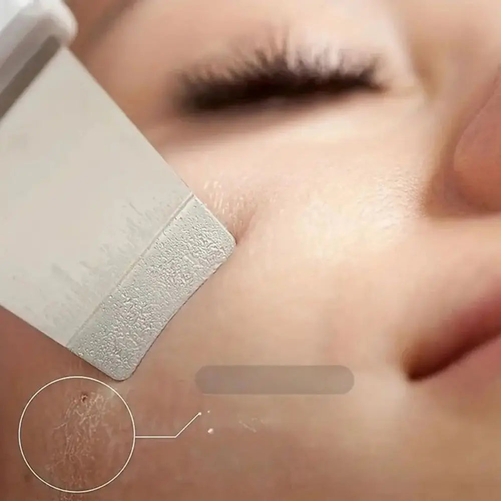 Ultrasonic Pore Skin Scraper.