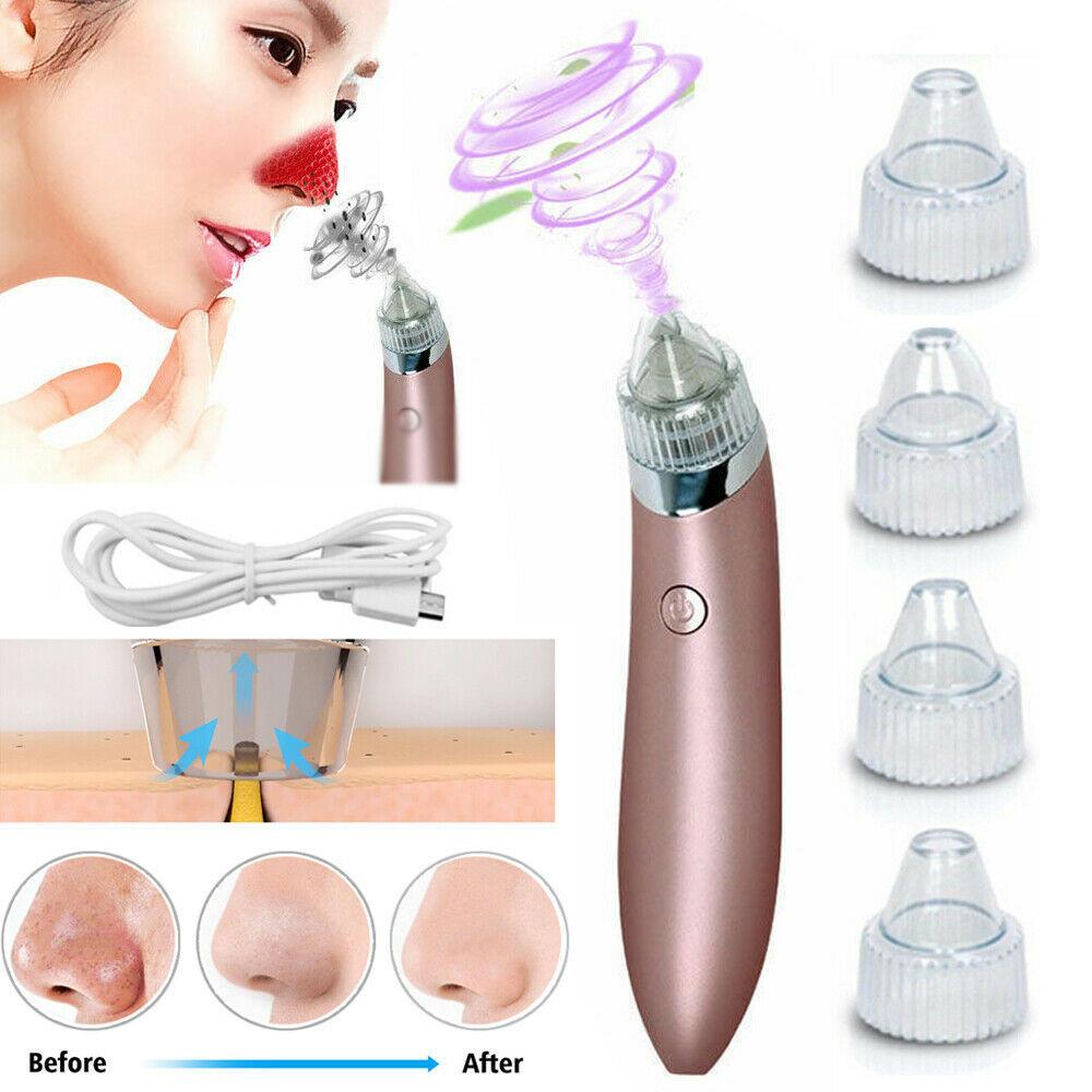 Electric Blackhead Vacuum Pore Cleaner Acne Pimple Remover Strong Suction Tool Electric Blackhead Remover Pore Vacuum Suction Diamond Dermabrasion Face Cleaner.